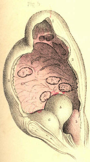 Illustration: