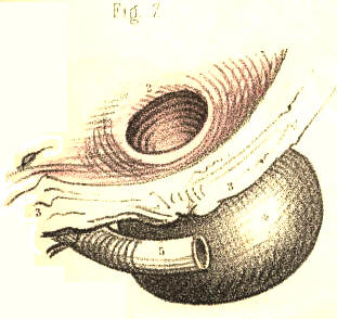Illustration: