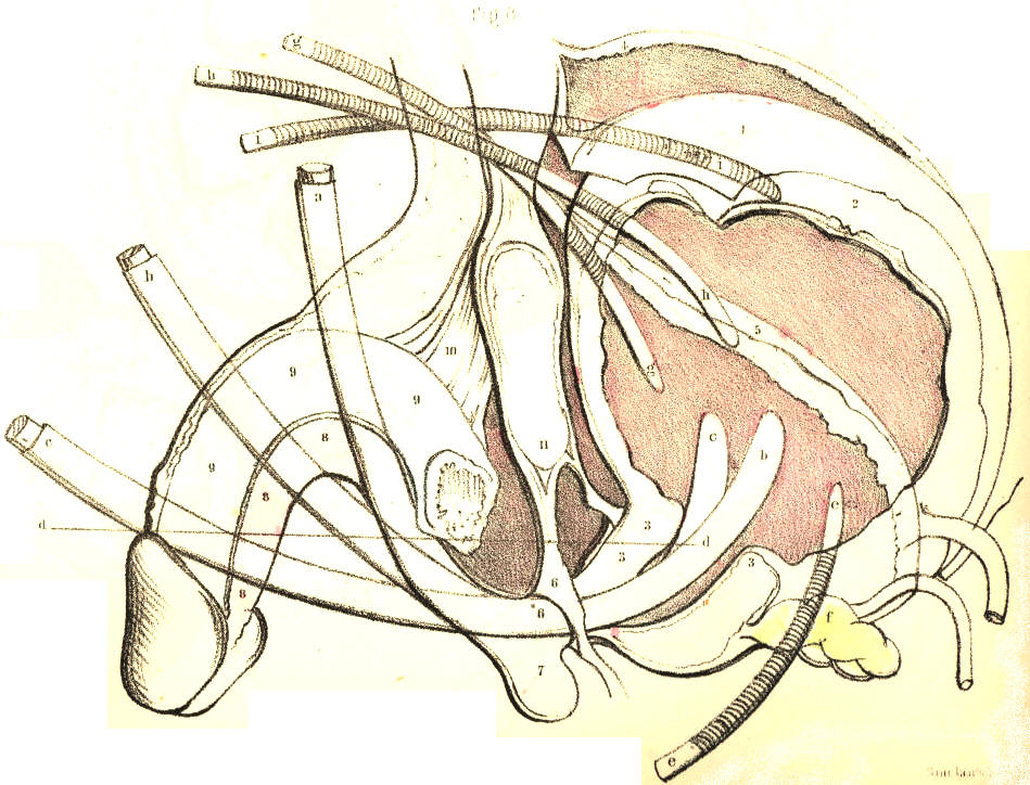 Illustration: