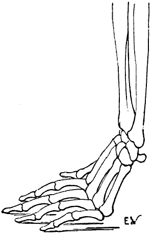 Fig. 23
