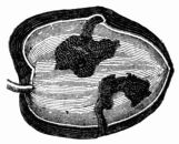 Fig. 68.—Gallery formed by larva of Dacus oleæ. Fig. 68.—Gallery formed by larva of Dacus oleæ.