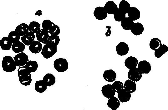 Illustration: Fig. 38. Red corpuscles of human blood,