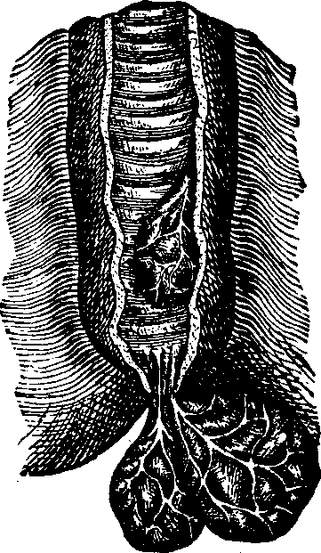 Illustration: Fig. 2. Piles: internal and protruding.