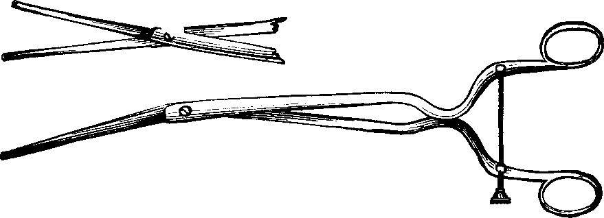 Illustration: Fig. 5. STOHLMAN'S HYSTEROTOME. This instrument has two cutting blades which shut past each other, as seen in the lower figure, so as not to cut when introduced into the canal of the uterine neck. After introduction, the cutting blades are separated, as shown in the upper figure, the extent of the incision being regulated by the thumb-screw attached to the handles, as represented in the lower figure.