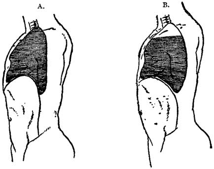 Fig. 14 Fig. 14