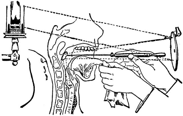 Fig. 38 Fig. 38