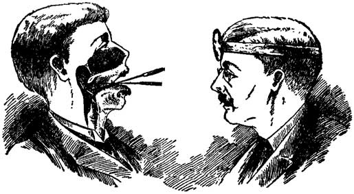 Fig. 39 Fig. 39