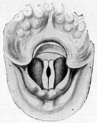 Fig. 45 Fig. 45