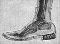 A X-ray photograph of a human foot inside a shoe, revealing the bones of the ankle and toes — an early demonstration of Röntgen's discovery, showing the diagnostic potential of X-rays through solid material.