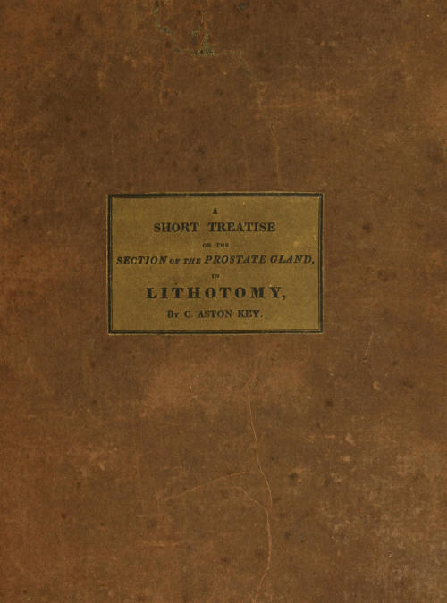 A Short Treatise on the Section of the Prostate Gland in Lithotomy