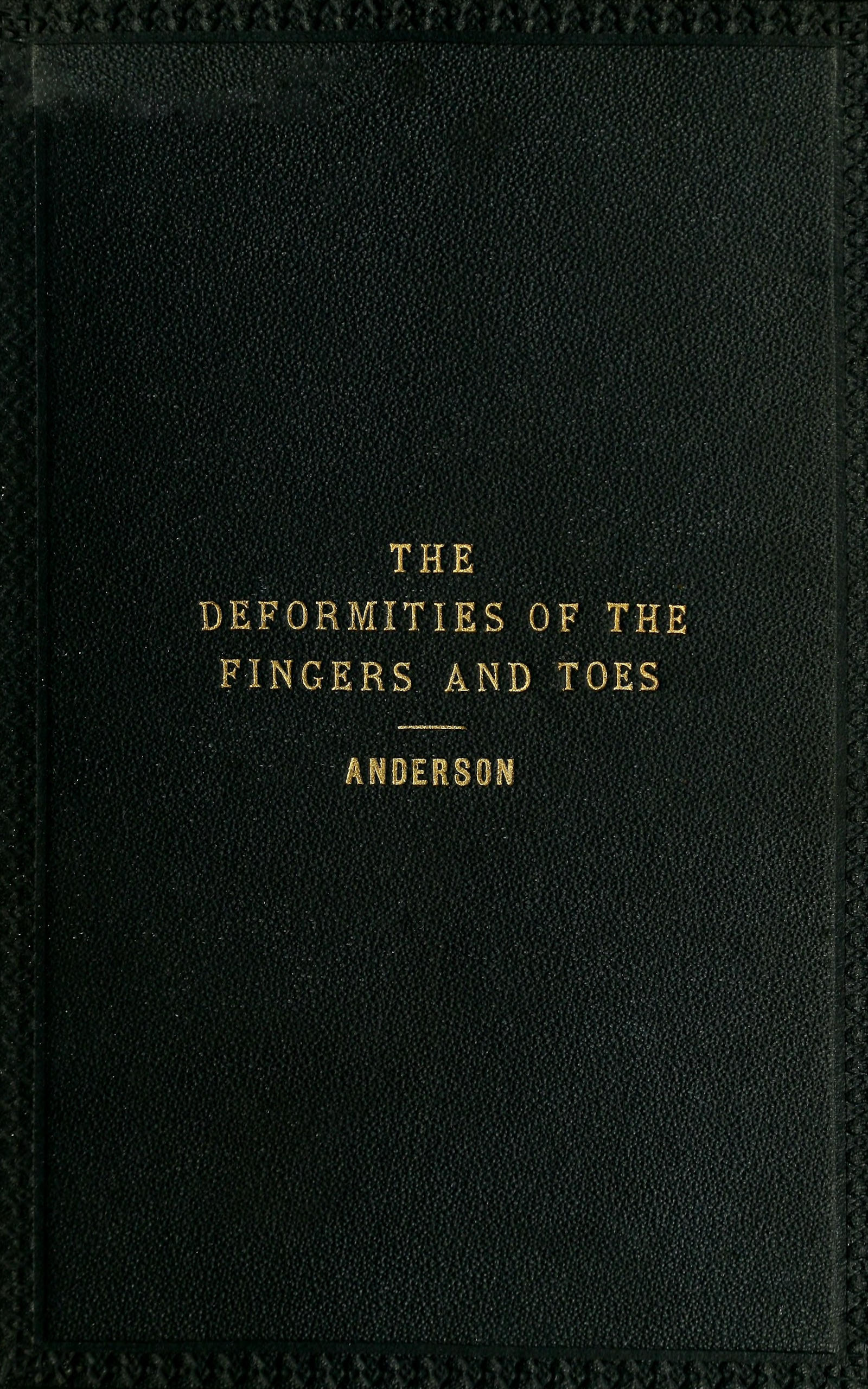 The Deformities of the Fingers and Toes